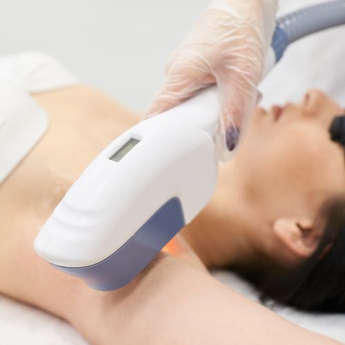 como aclarar tus axilas con depilacion laser